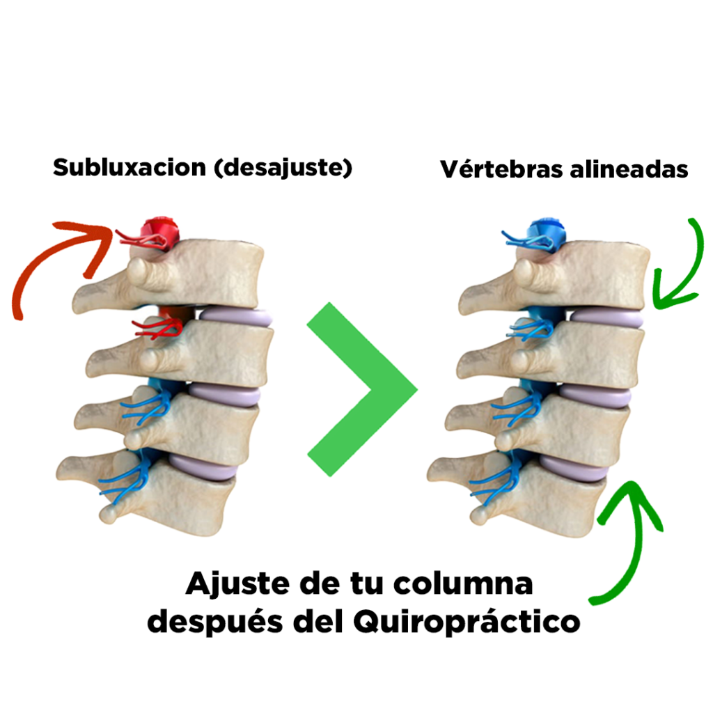 Corregir el desajuste vertebral